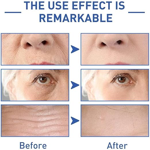 🌟 Retinol Caffeine Anti-Wrinkle Eye Cream – Bright, Youthful Eyes Every Day! 👁✨ Unique MAll