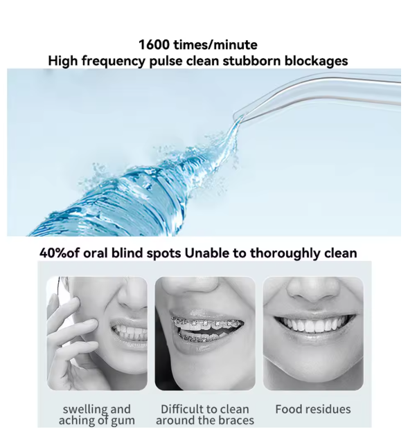 Oral Irrigator – Find Your Beauty TrendyZone